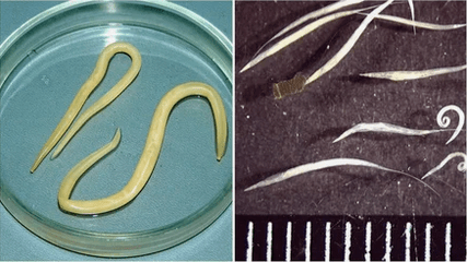 Human Worms
